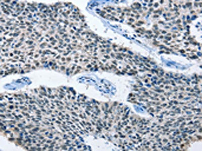 Anti-ELAVL1