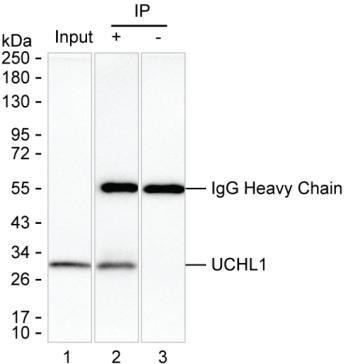 Anti-UCHL1
