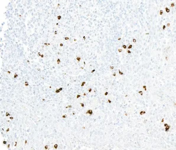 Anti-CX3CR1 Recombinant Monoclonal