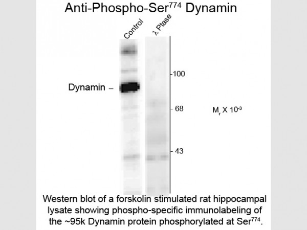 Anti-phospho-Dynamin (Ser774)