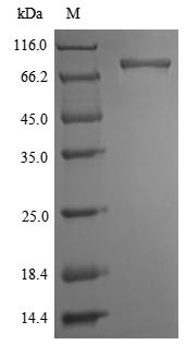 Receptor-interacting serine/threonine-protein kinase 1 (Ripk1), mouse, recombinant