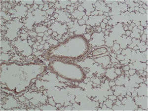Anti-GSK3B