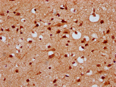 Anti-KLHL20