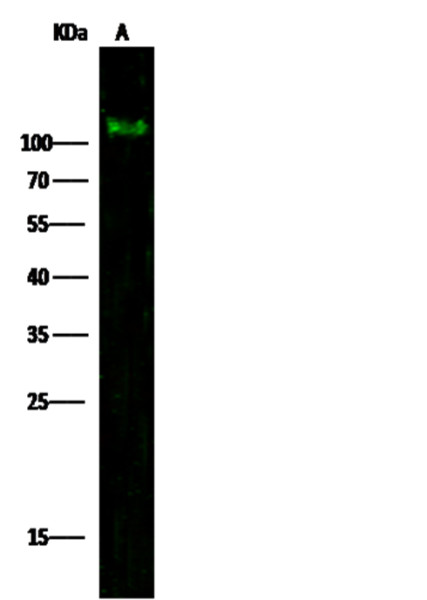 Anti-PDGFRA/CD140a Monoclonal Antibody