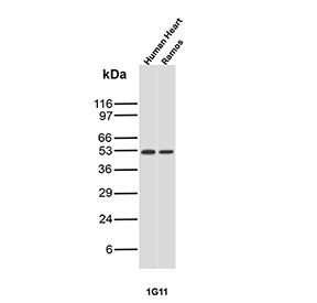 Anti-ETS1 / Protein C-ets-1, clone r1G11