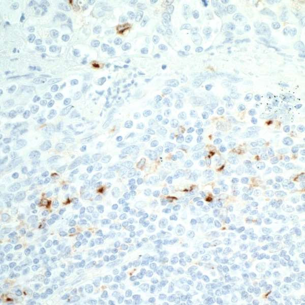 Anti-CD137 Recombinant Monoclonal