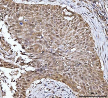 Anti-14-3-3 gamma / YWHAG