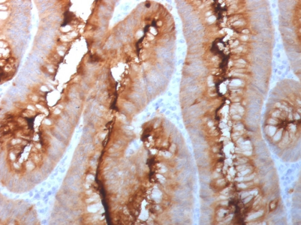 Anti-Carcinoembryonic Antigen (CEA) / CD66
