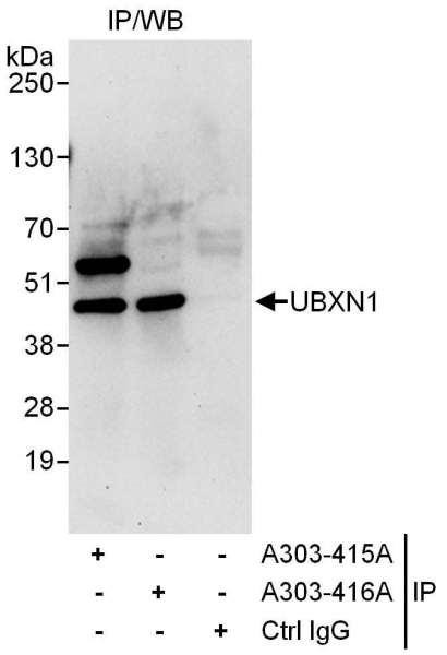 Anti-UBXN1