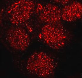 Anti-phospho-STAT3 (Ser727)