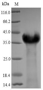 Latent membrane protein 1 (LMP1), partial, Epstein-Barr virus, recombinant