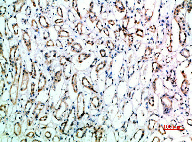 Anti-CD151