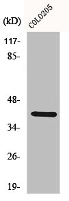 Anti-CDKL1