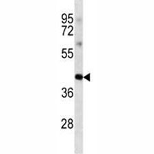 Anti-Oct4, clone 341CT7.6.2