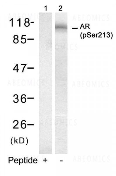Anti-phospho-Androgen Receptor (Ser213)