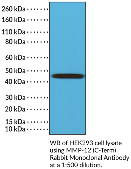 Anti-MMP-12 (C-Term) Rabbit Monoclonal Antibody (Clone RM381)