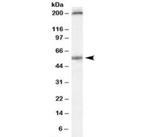 Anti-Serotonin Receptor 3A