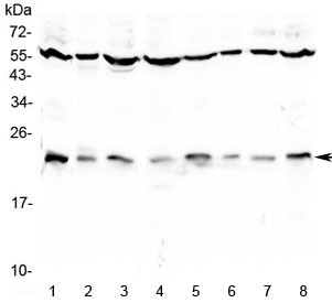 Anti-IL1RA / Interleukin-1 Receptor Antagonist