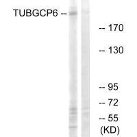 Anti-TUBGCP6