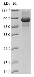 Ferrochelatase, mitochondrial (FECH), bovine, recombinant