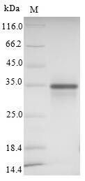 Sialic acid-binding Ig-like lectin 15 (SIGLEC15), partial, human, recombinant