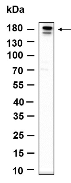 Anti-Recombinant Phospho-ErbB-3 (Tyr1289), clone 11A5