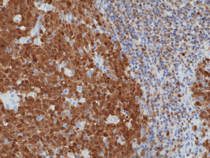 Anti-BOB-1 (human), Rabbit Monoclonal (RM378)