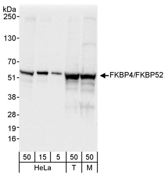 Anti-FKBP4/FKBP52