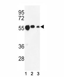 Anti-beta Tubulin