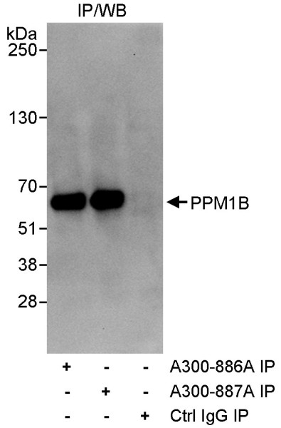 Anti-PPM1B