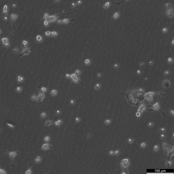 MDA-MB-436 Cells