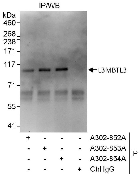 Anti-L3MBTL3