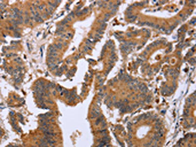 Anti-EPDR1