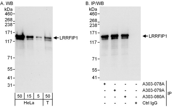 Anti-LRRFIP1