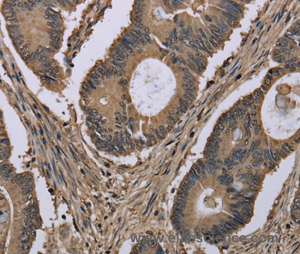 Anti-MYO18B