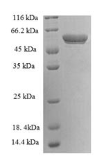 14-3-3 protein eta (YWHAH), partial, human, recombinant