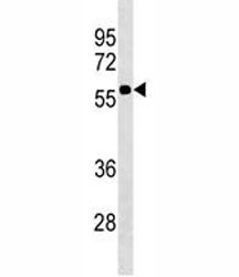 Anti-CD1a, clone 437CT28.2.1