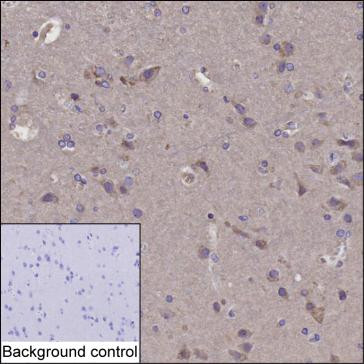 Anti-HMGCR