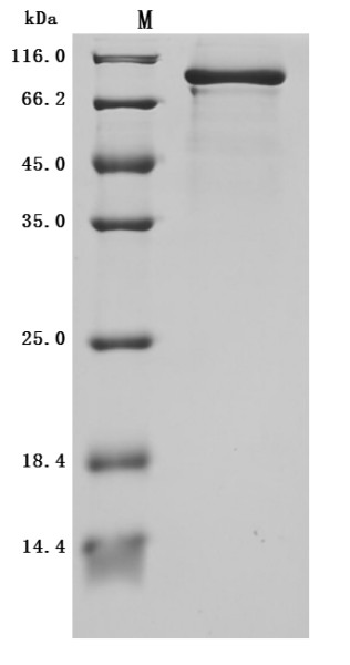 Plexin-B1 (PLXNB1), partial (Active), human, recombinant
