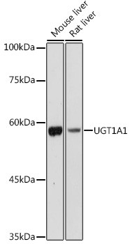 Anti-UGT1A1