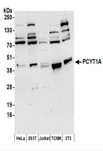 Anti-PCYT1A