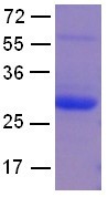 Ran Q69L mutant (Ras-related nuclear protein, TC4, Gsp1, ARA24), human, recombinant full length, His