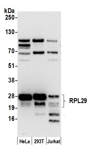 Anti-RPL29/ Ribosomal Protein L29