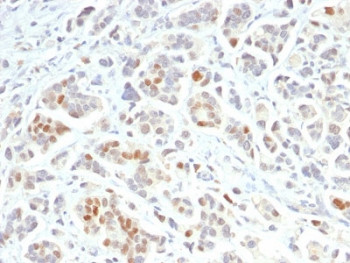 Anti-GATA3, clone GATA3/2688