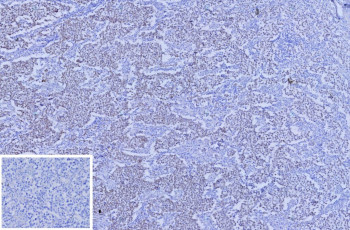 Anti-SALL4 / Sal-like protein 4, clone SALL4/12615