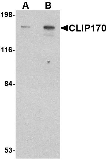 Anti-CLIP1 / CLIP170