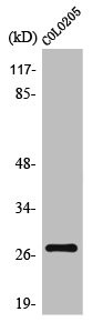 Anti-TP53INP1