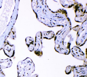 Anti-AFF4 / AF4/FMR2 family member 4