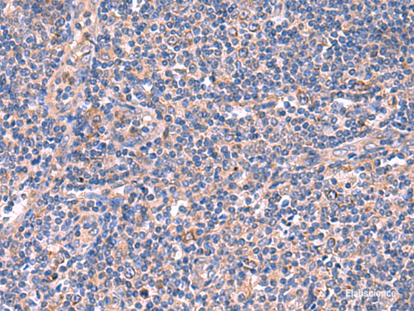 Anti-MPP1