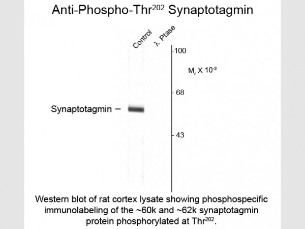 Anti-phospho-Synaptotagmin (Thr202)